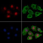 Phospho-MSK2 (Ser360) Polyclonal Antibody