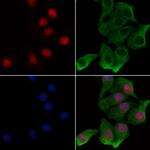 Phospho-NFAT5 (Ser134) Polyclonal Antibody