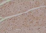 Phospho-MPZL1 (Tyr241) Antibody in Immunohistochemistry (Paraffin) (IHC (P))