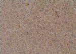 Phospho-MPZL1 (Tyr260) Antibody in Immunohistochemistry (Paraffin) (IHC (P))