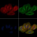 Phospho-LATS1 (Ser909) Polyclonal Antibody