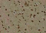 Phospho-LDHA (Tyr239) Antibody in Immunohistochemistry (Paraffin) (IHC (P))