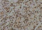 Phospho-CD25 (Ser268) Antibody in Immunohistochemistry (Paraffin) (IHC (P))
