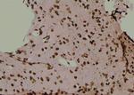 Phospho-CD25 (Ser268) Antibody in Immunohistochemistry (Paraffin) (IHC (P))