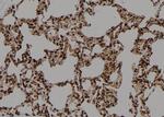 Phospho-CD25 (Ser268) Antibody in Immunohistochemistry (Paraffin) (IHC (P))