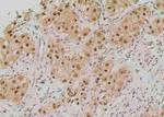 Phospho-TK1 (Tyr181) Polyclonal Antibody