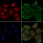 Phospho-ErbB2 (HER-2) (Tyr1005) Polyclonal Antibody