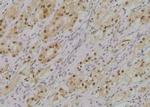 Phospho-ErbB2 (HER-2) (Tyr1005) Antibody in Immunohistochemistry (Paraffin) (IHC (P))