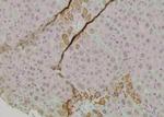Phospho-ErbB2 (HER-2) (Tyr1005) Antibody in Immunohistochemistry (Paraffin) (IHC (P))