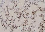 Phospho-ErbB2 (HER-2) (Tyr1005) Antibody in Immunohistochemistry (Paraffin) (IHC (P))