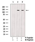 Phospho-ErbB2 (HER-2) (Ser1054) Antibody in Western Blot (WB)