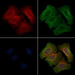 Phospho-ErbB2 (HER-2) (Tyr1023) Antibody in Immunocytochemistry (ICC/IF)