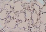 Phospho-ErbB2 (HER-2) (Tyr1023) Antibody in Immunohistochemistry (Paraffin) (IHC (P))