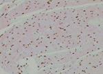 Phospho-p53 (Tyr327) Antibody in Immunohistochemistry (Paraffin) (IHC (P))