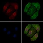 Phospho-PKC beta (Ser661) Polyclonal Antibody