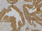 Phospho-Cytokeratin 18 (Tyr36) Antibody in Immunohistochemistry (Paraffin) (IHC (P))