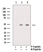 Phospho-Cytokeratin 18 (Tyr36) Antibody in Western Blot (WB)