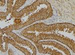 Phospho-Cytokeratin 18 (Tyr13) Antibody in Immunohistochemistry (Paraffin) (IHC (P))