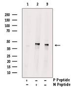 Phospho-Cytokeratin 18 (Tyr13) Antibody in Western Blot (WB)