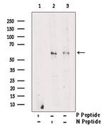 Phospho-LCK (Tyr505) Polyclonal Antibody