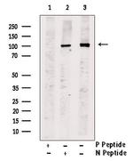 Phospho-Progesterone Receptor (Ser79, Ser81) Antibody in Western Blot (WB)