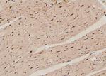Phospho-Lyn (Tyr193) Antibody in Immunohistochemistry (Paraffin) (IHC (P))