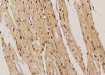 Phospho-IGF1R (CD221) (Thr1163) Antibody in Immunohistochemistry (Paraffin) (IHC (P))