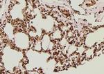 Phospho-IGF1R (CD221) (Thr1163) Antibody in Immunohistochemistry (Paraffin) (IHC (P))