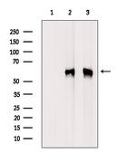 Phospho-HCK (Tyr522) Polyclonal Antibody