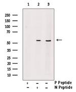 Phospho-Vimentin (Tyr117) Antibody in Western Blot (WB)