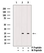 Phospho-CD79a (Tyr199) Antibody in Western Blot (WB)