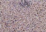 Phospho-GYS1 (Tyr44) Polyclonal Antibody