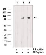 Phospho-HCLS1 (Tyr198) Polyclonal Antibody