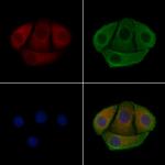 Phospho-p47phox (Ser304) Polyclonal Antibody