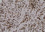 Phospho-PKM2 (Tyr148) Polyclonal Antibody