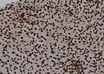 Phospho-PKM2 (Tyr148) Antibody in Immunohistochemistry (Paraffin) (IHC (P))