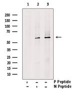 Phospho-PKM2 (Tyr148) Antibody in Western Blot (WB)