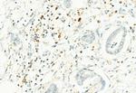 Phospho-PKM2 (Ser37) Antibody in Immunohistochemistry (Paraffin) (IHC (P))