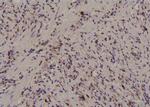 Phospho-PKM2 (Ser37) Antibody in Immunohistochemistry (Paraffin) (IHC (P))