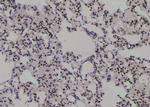 Phospho-PKM2 (Ser37) Antibody in Immunohistochemistry (Paraffin) (IHC (P))