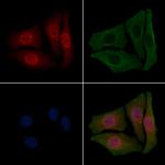 Phospho-BRAF (Ser729) Polyclonal Antibody