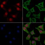 Phospho-FER (Tyr497) Polyclonal Antibody