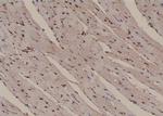 Phospho-PLCG2 (Tyr1245) Polyclonal Antibody