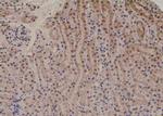 Phospho-PKC alpha (Tyr365) Polyclonal Antibody