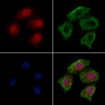 Phospho-PKC alpha (Tyr195) Polyclonal Antibody