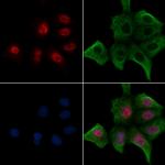 Phospho-JunB (Thr255) Polyclonal Antibody