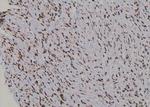 Phospho-UBF-1 (Thr117) Polyclonal Antibody