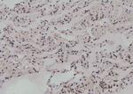 Phospho-UBF-1 (Thr117) Antibody in Immunohistochemistry (Paraffin) (IHC (P))