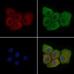 Phospho-VEGF Receptor 1 (Tyr1048) Polyclonal Antibody