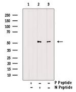 Phospho-GABRB1 (Ser409) Polyclonal Antibody